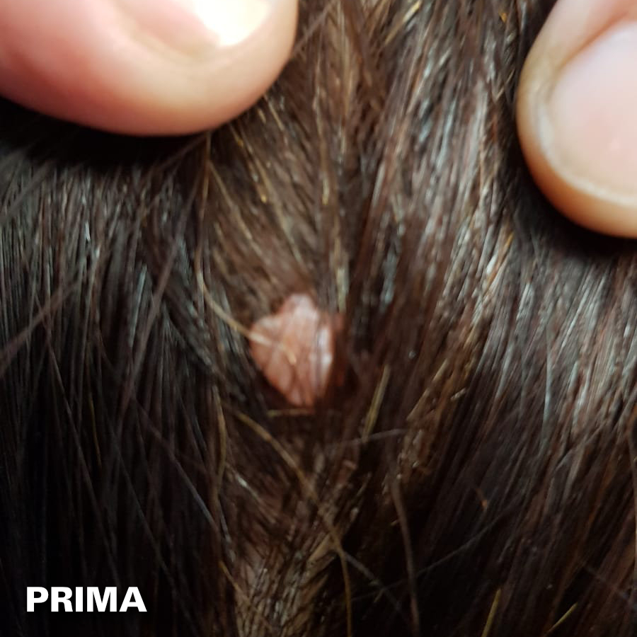 Fibromi - Prima